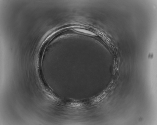 X0000099290247200805161332