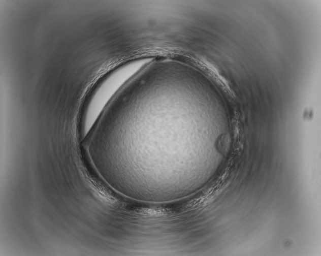 X0000099290250200805161332