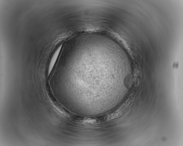 X0000099290257200805161332