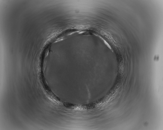 X0000099290303200805161331