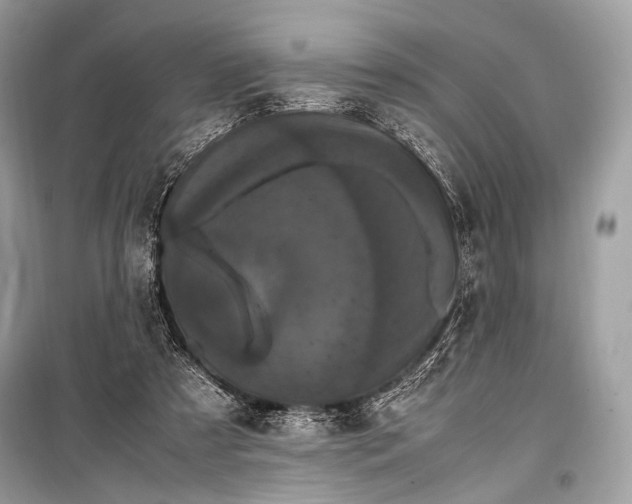 X0000099290305200805161331