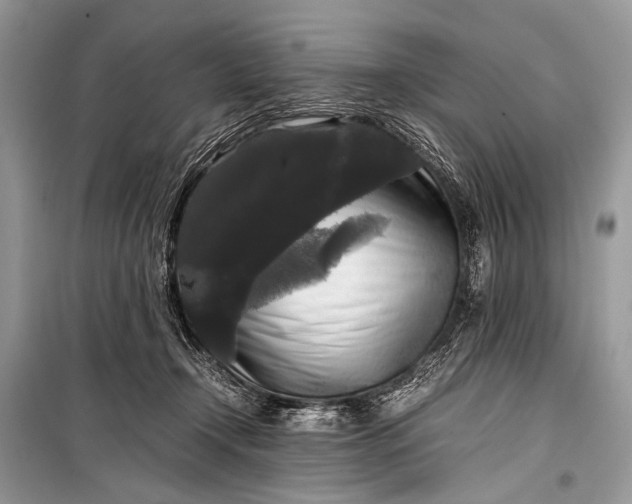 X0000099290366200805161330