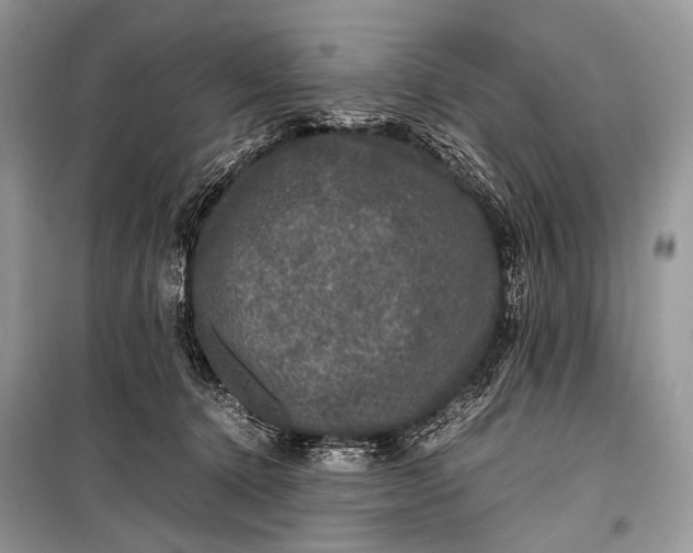 X0000099290368200805161330