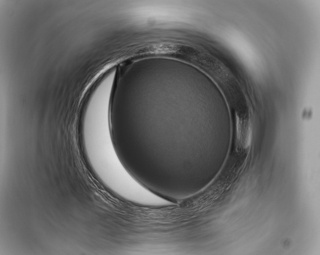 X0000099290387200805161330