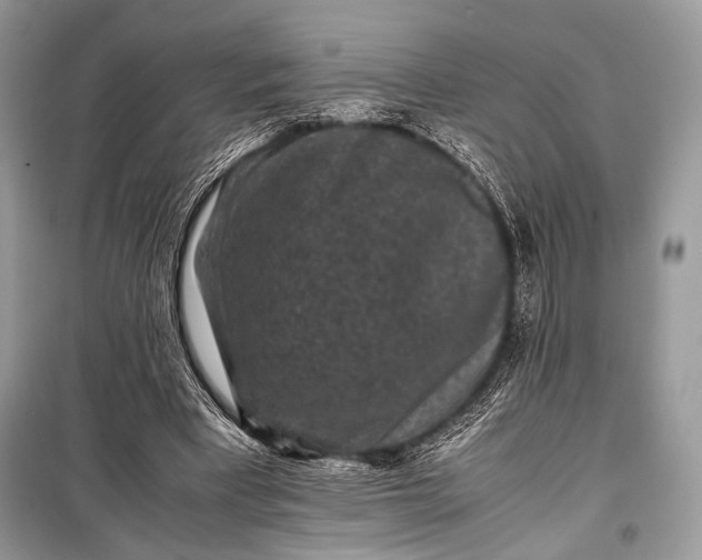 X0000099290393200805161330