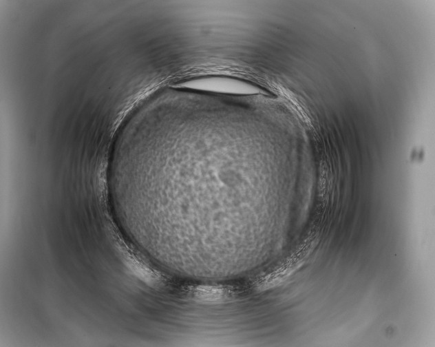 X0000099290394200805161330