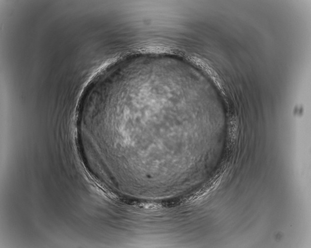 X0000099290395200805161330