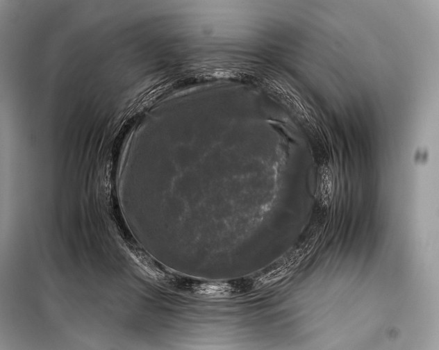 X0000099290410200805161330