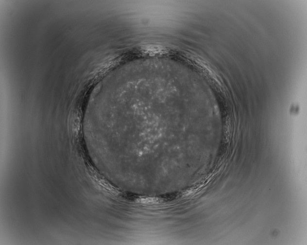 X0000099290417200805161330