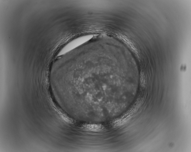 X0000099290449200805161329