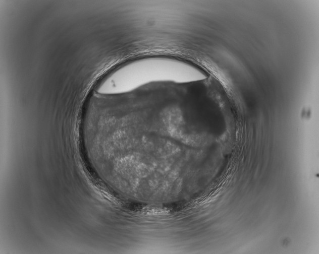 X0000099290491200805161328