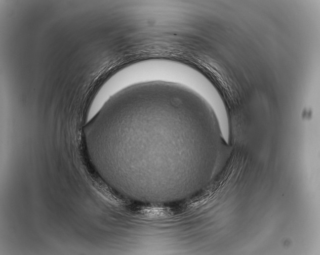 X0000099290499200805161328