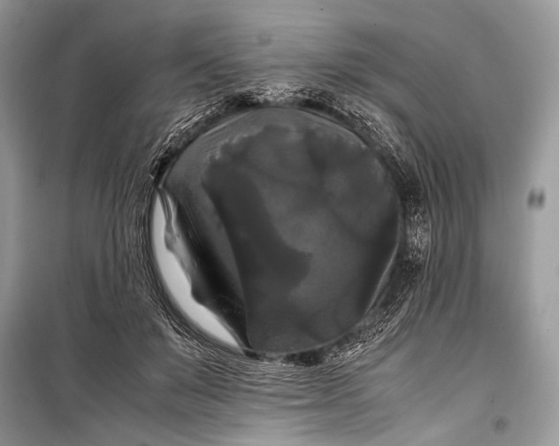 X0000099290503200805161328