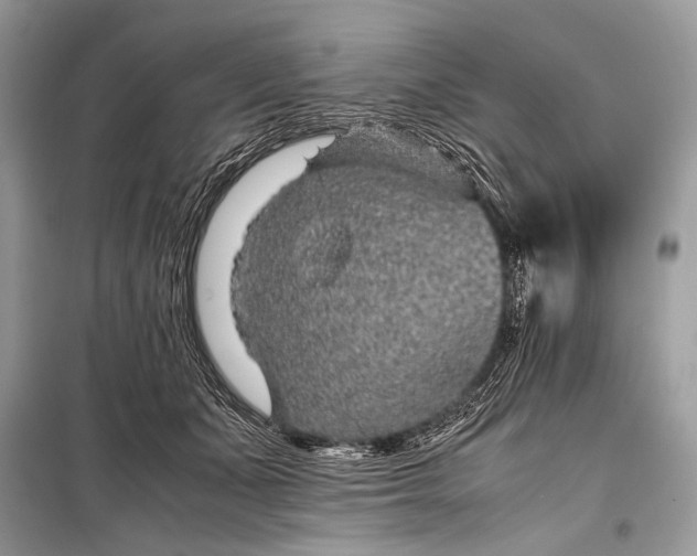 X0000099290511200805161328