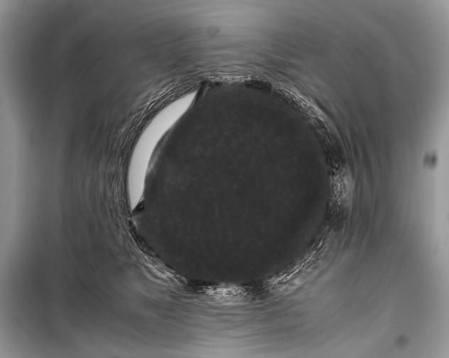 X0000099290517200805161328