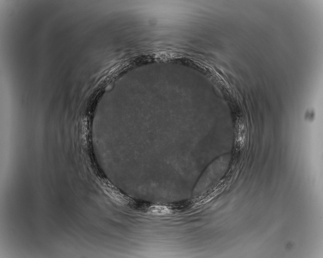 X0000099290519200805161328