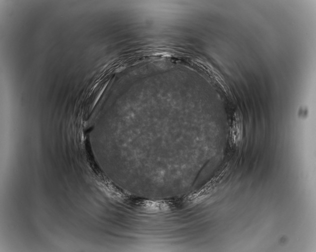 X0000099290520200805161328