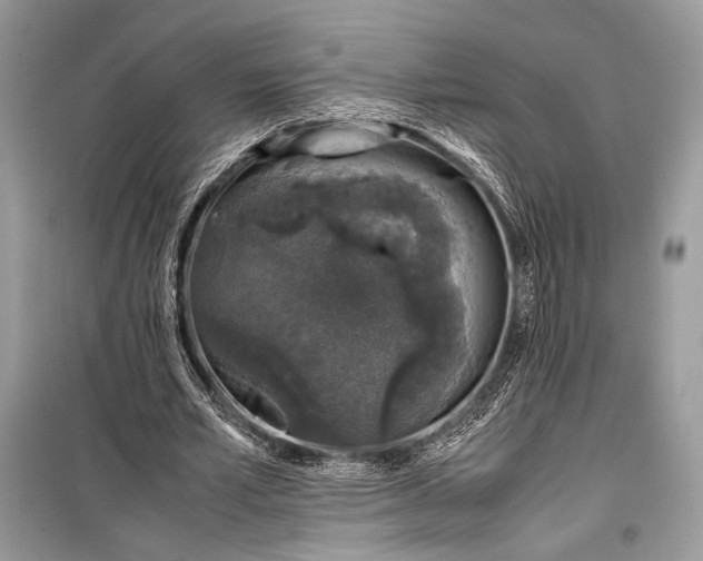 X0000099290581200805161327