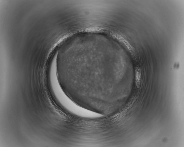 X0000099290684200805161325