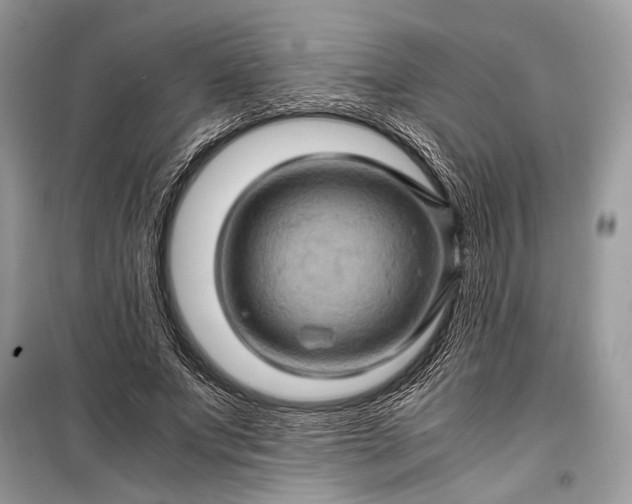 X0000099290687200805161325