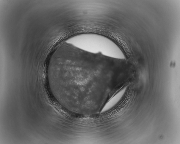 X0000099290691200805161325