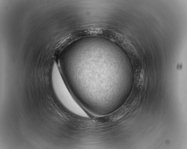 X0000099290704200805161325