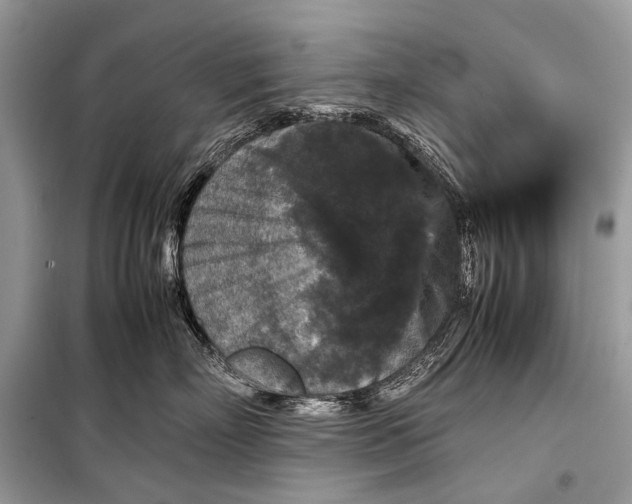 X0000099290718200805161325