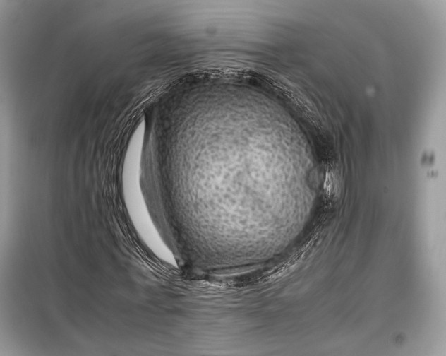 X0000099290771200805161324