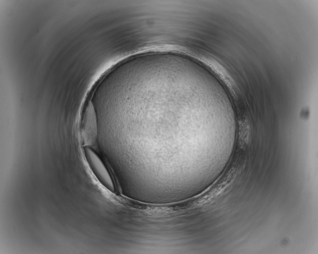 X0000099291046200805161320