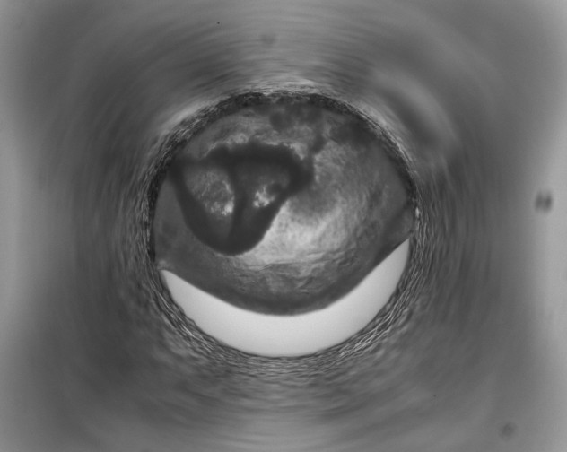 X0000099291063200805161320