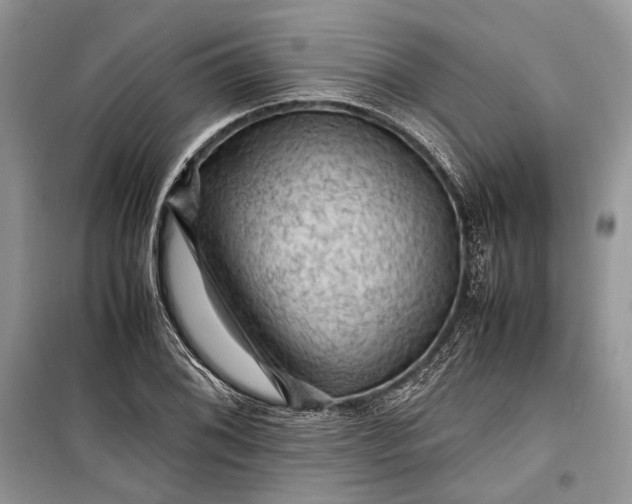 X0000099291076200805161320