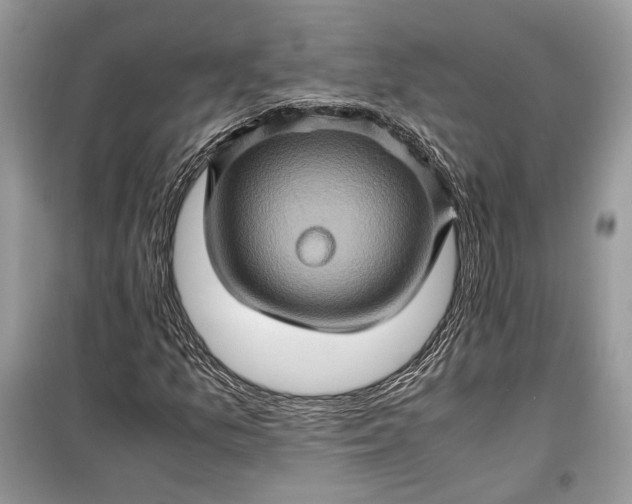 X0000099291157200805161318