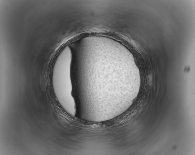 X0000099291160200805161318