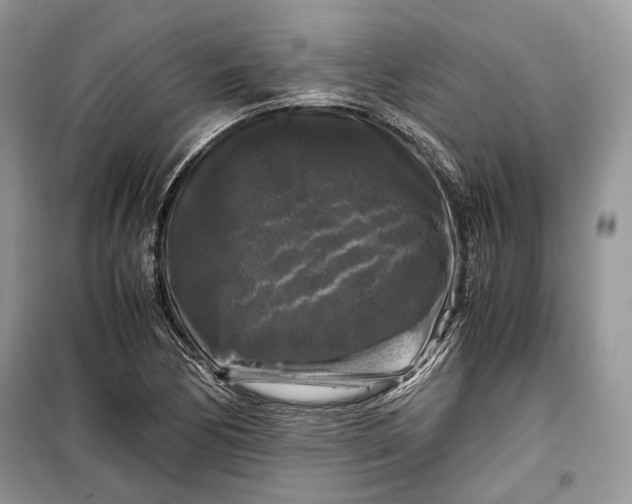 X0000099291170200805161318