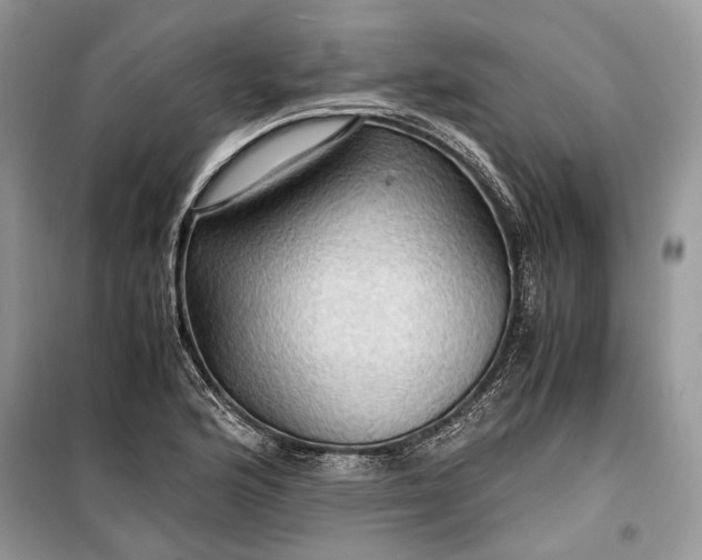 X0000099291176200805161318