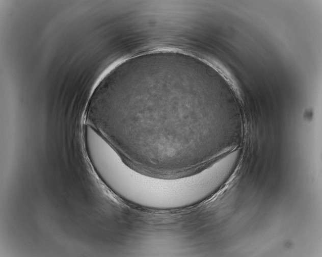 X0000099291198200805161318