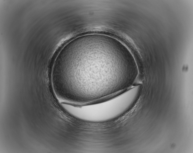 X0000099291218200805161317