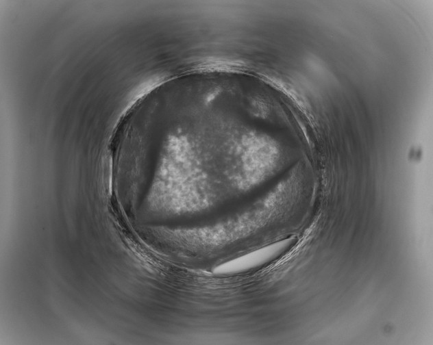 X0000099291219200805161317