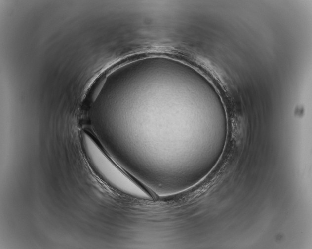 X0000099291260200805161317