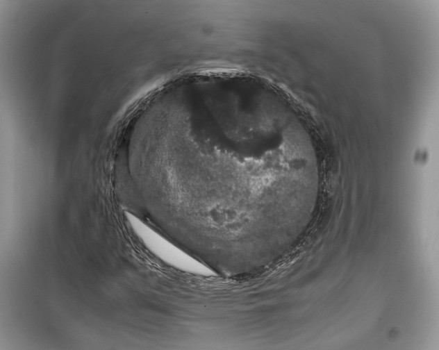 X0000099291351200805161315