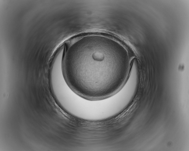 X0000099291356200805161315