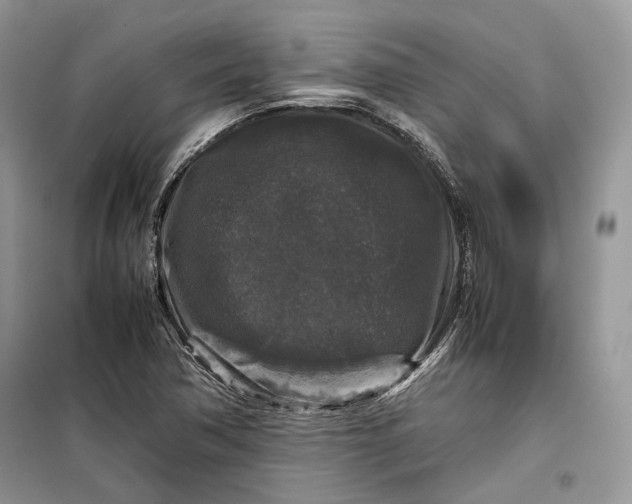 X0000099291362200805161315