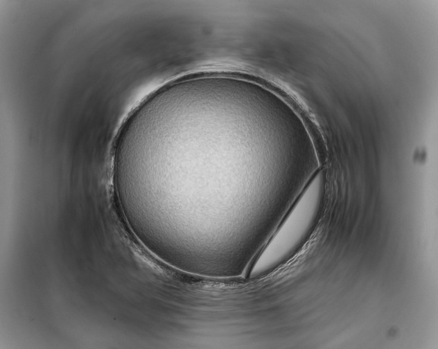 X0000099291366200805161315