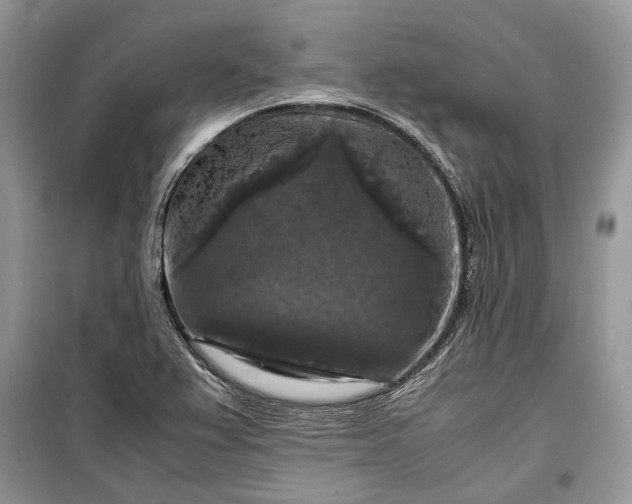 X0000099291367200805161315