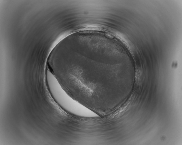 X0000099291378200805161315