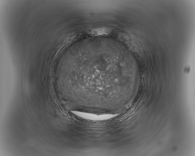 X0000099291393200805161314