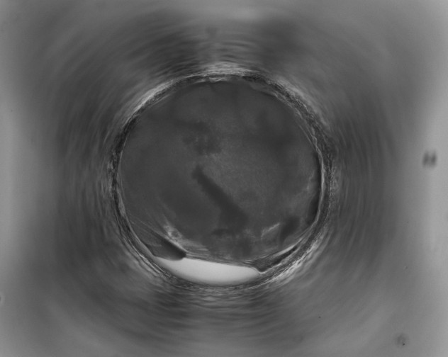 X0000099291401200805161314