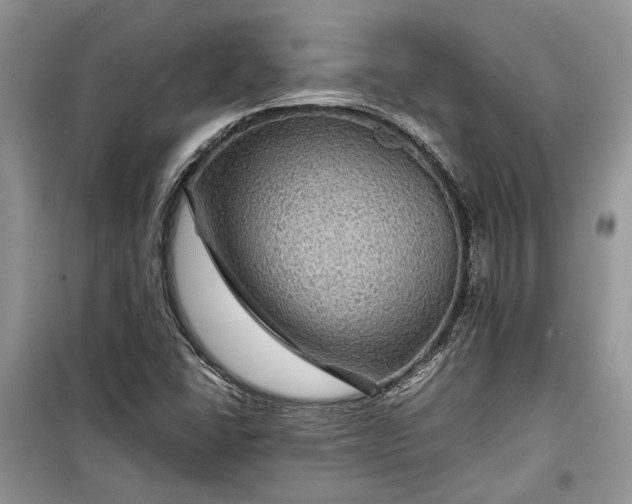 X0000099291406200805161314