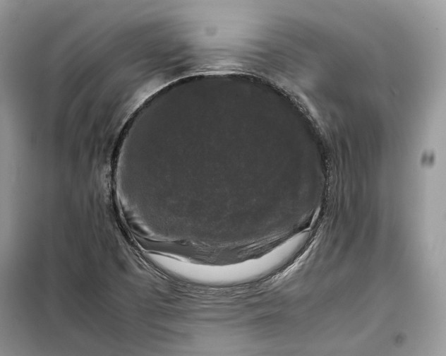 X0000099291457200805161314