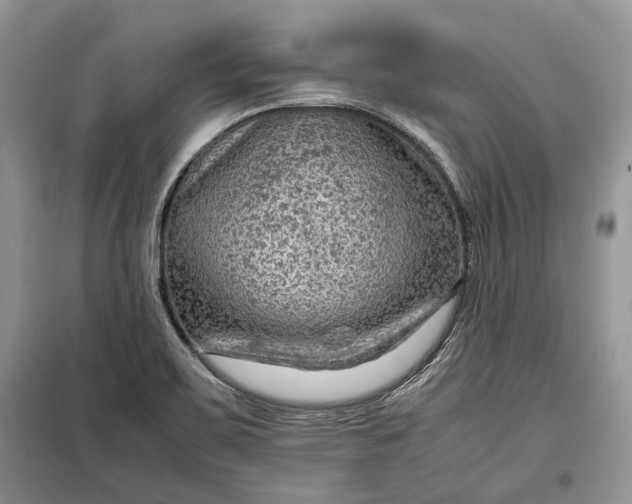 X0000099291467200805161314